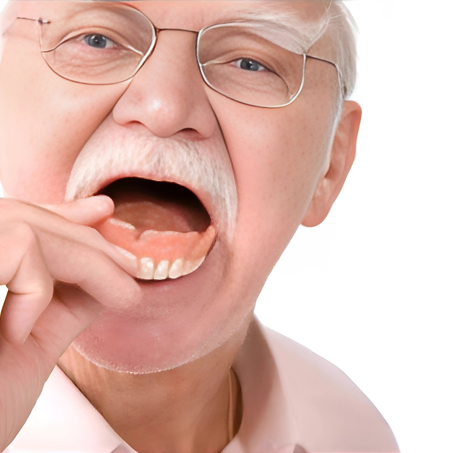AlignaDent™ - Denture Set
