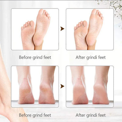 Smooth Steps Foot Care Kit